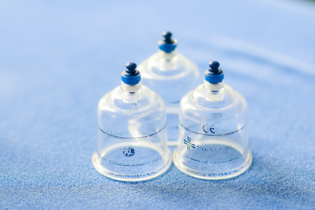 cupping-amsterdam-massage